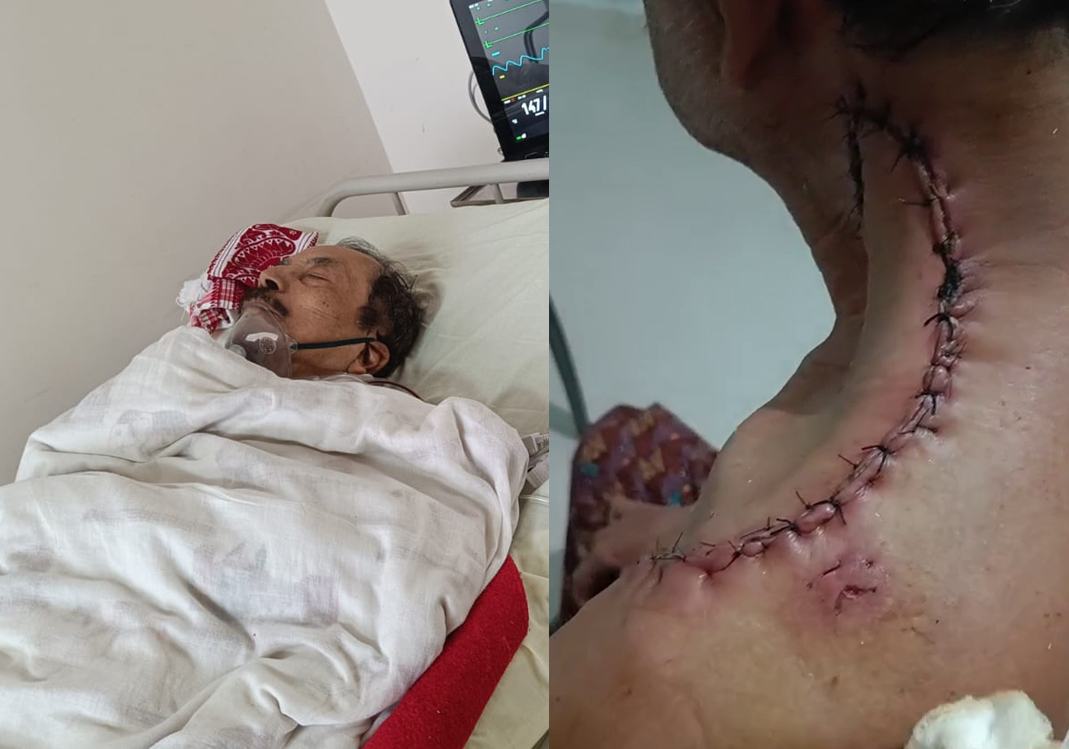 Critical After Accident, Debendra Needs Urgent Support